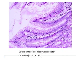 Epitélio simples cilíndrico mucossecretor
Tecido conjuntivo frouxo
 