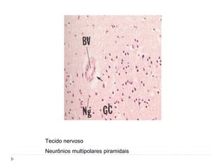 Tecido nervoso
Neurônios multipolares piramidais
 