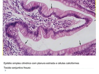Epitélio simples cilíndrico com planura estriada e células caliciformes
Tecido conjuntivo frouxo
 