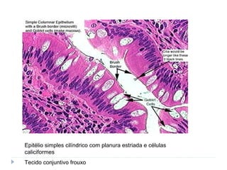 Epitélio simples cilíndrico com planura estriada e células
caliciformes
Tecido conjuntivo frouxo
 