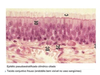 Epitélio pseudoestratificado cilíndrico ciliado
Tecido conjuntivo frouxo (endotélio bem visível no vaso sangüíneo)
 