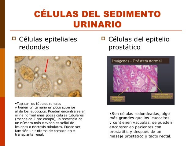Urinario Urinario