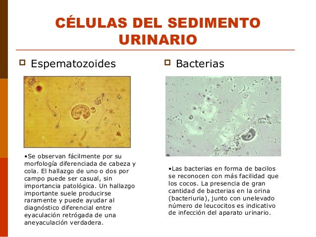 Atlas del sedimento urinario
