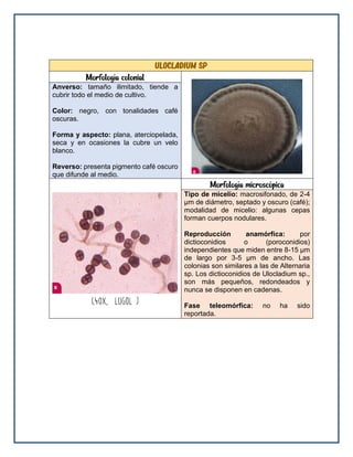 ulocladium sp
Morfología colonial
Anverso: tamaño ilimitado, tiende a
cubrir todo el medio de cultivo.
Color: negro, con tonalidades café
oscuras.
Forma y aspecto: plana, aterciopelada,
seca y en ocasiones la cubre un velo
blanco.
Reverso: presenta pigmento café oscuro
que difunde al medio.
Morfología microscópica
Tipo de micelio: macrosifonado, de 2-4
μm de diámetro, septado y oscuro (café);
modalidad de micelio: algunas cepas
forman cuerpos nodulares.
Reproducción anamórfica: por
dictioconidios o (poroconidios)
independientes que miden entre 8-15 μm
de largo por 3-5 μm de ancho. Las
colonias son similares a las de Alternaria
sp. Los dictioconidios de Ulocladium sp.,
son más pequeños, redondeados y
nunca se disponen en cadenas.
Fase teleomórfica: no ha sido
reportada.
 