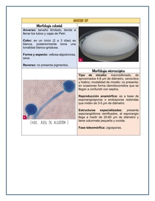 Mucor sp
Morfología colonial
Anverso: tamaño ilimitado, tiende a
llenar los tubos y cajas de Petri.
Color: en un inicio (2 a 3 días) es
blanca, posteriormente toma una
tonalidad blanco-grisácea.
Forma y aspecto: vellosa-algodonosa,
seca.
Reverso: no presenta pigmentos.
Morfología microscópica
Tipo de micelio: macrosifonado, de
aproximados 4-8 μm de diámetro, cenocítico
y hialino; modalidad de micelio: no presenta;
en ocasiones forma clamidoconidios que se
llegan a confundir con septos.
Reproducción anamórfica: es a base de
esporangiosporas o endosporas redondas
que miden de 3-5 μm de diámetro.
Estructuras especializadas: presenta
esporangióforos ramificados, el esporangio
llega a medir de 20-80 μm de diámetro y
tiene columnela pequeña y ovoide.
Fase teleomórfica: zigosporas.
 