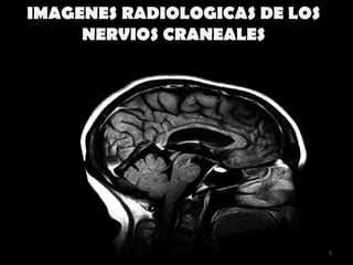IMAGENES RADIOLOGICAS DE LOS
     NERVIOS CRANEALES




                               1
 