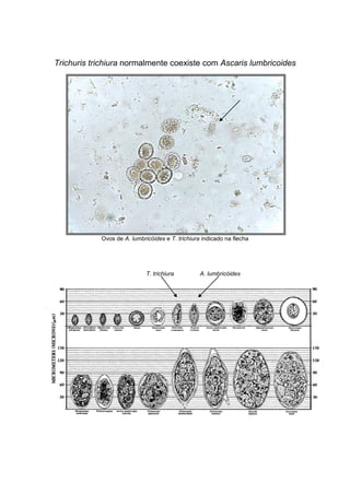 Trichuris trichiura normalmente coexiste com Ascaris lumbricoides
Ovos de A. lumbricóides e T. trichiura indicado na flecha
T. trichiura A. lumbricóides
 