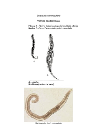 Enterobius vermicularis
Vermes adultos: lavas
Fêmea: 8 – 12mm. Extremidade posterior afilada e longa
Macho: 3 – 5mm. Extremidade posterior enrolada
A – macho
B – fêmea (repleta de ovos)
Macho adulto de E. vermicularis
 
