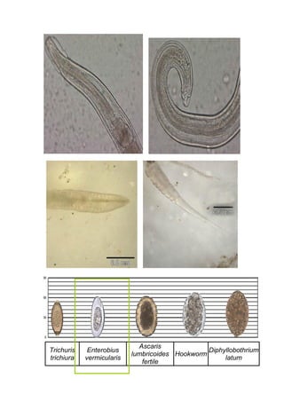 Trichuris
trichiura
Enterobius
vermicularis
Ascaris
lumbricoides
fertile
Hookworm
Diphyllobothrium
latum
 