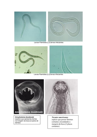 Larvas Filarióides (L3) larvas infectantes
Larvas Filarióides (L3) larvas infectantes
Ancylostoma duodenale
espécie que apresenta dentes
na margem da boca (2 pares de
dentes)
Necator americanus
espécie que possui lâminas
cortantes circundando a
margem da boca (2 placas
cortantes)
 