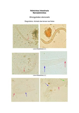 Helmintos Intestinais
Nematelmintos
Strongyloides stercoralis
Diagnóstico: Achado das larvas nas fezes
Larva Rabditóide (L1)
Larva Rabditóide (L1)
 