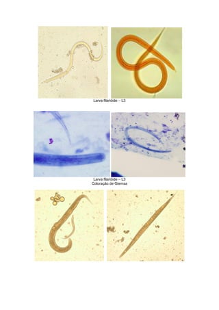 Larva filarióide – L3
Larva filarióide – L3
Coloração de Giemsa
 