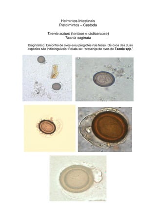 Helmintos Intestinais
Platelmintos – Cestoda
Taenia solium (teníase e cisticercose)
Taenia saginata
Diagnóstico: Encontro de ovos e/ou proglotes nas fezes. Os ovos das duas
espécies são indistinguíveis: Relata-se: “presença de ovos de Taenia spp.”
 