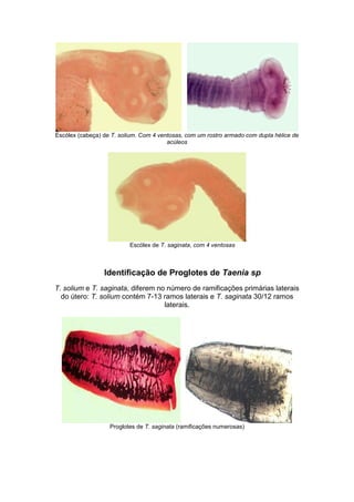 Escólex (cabeça) de T. solium. Com 4 ventosas, com um rostro armado com dupla hélice de
acúleos
Escólex de T. saginata, com 4 ventosas
Identificação de Proglotes de Taenia sp
T. solium e T. saginata, diferem no número de ramificações primárias laterais
do útero: T. solium contém 7-13 ramos laterais e T. saginata 30/12 ramos
laterais.
Proglotes de T. saginata (ramificações numerosas)
 