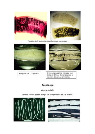Proglotes de T. solium (ramificações pouco numerosas)
Taenia spp
Verme adulto
Vermes adultos podem atingir um comprimento de 2-8 metros.
O mesmo proglote injetado com
tinta da China, demonstrando o
número de ramos primários
uterino
Proglotes de T. saginata
 