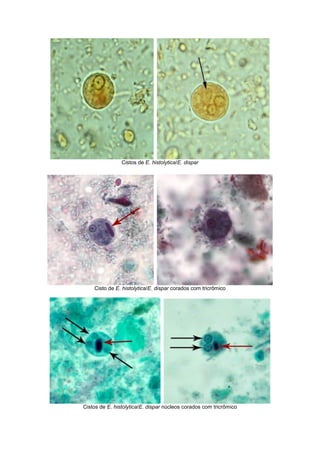 Cistos de E. histolytica/E. dispar
Cisto de E. histolytica/E. dispar corados com tricrômico
Cistos de E. histolytica/E. dispar núcleos corados com tricrômico
 