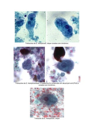 Trofozoítos de E. histolytica/E. dispar corados com tricrômico.
Trofozoítos de E. histolytica/dispar. O espécime foi conservado em álcool poli vinil (PVA) e
corados com tricrômico.
Trofozoíto de E. histolytica/E. dispar
 