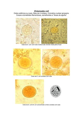 Entamoeba coli
Cistos esféricos ou ovais. Mais de 4 núcleos. Cromatina nuclear grosseira.
Corpos cromatóides filamentosos, semelhantes a “feixes de agulha”
Cisto de E. coli. Com seis núcleos são visíveis neste plano focal
Cisto de E. coli coradas com iodo
Cisto de E. coli em um concentrado úmido coradas com iodo
 