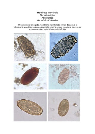 Helmintos Intestinais
Nematelmintos
Ascaridíase
Ascaris lumbricoides
Ovos inférteis: alongado, membrana mamilonada é mais delgada e o
citoplasma granuloso e opaco. A camada externa é mais irregular e os ovos se
apresentam com material interno indefinido.
 