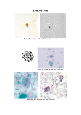 Endolimax nana
Cisto de E. nana em directo molhado coradas com iodo
Cistos de E. nana corados com tricrômico
Trofozoítos de E. nana corados com tricrômico
 