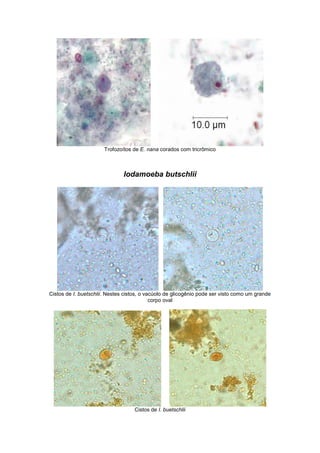 Trofozoítos de E. nana corados com tricrômico
Iodamoeba butschlii
Cistos de I. buetschlii. Nestes cistos, o vacúolo de glicogênio pode ser visto como um grande
corpo oval
Cistos de I. buetschlii
 