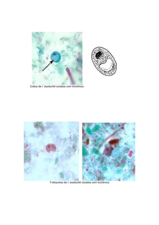 Cistos de I. buetschlii corados com tricrômico
Trofozoítos de I. buetschlii corados com tricrômico
 