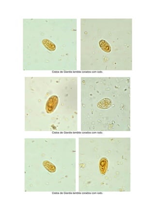 Cistos de Giardia lamblia corados com iodo.
Cistos de Giardia lamblia corados com iodo.
Cistos de Giardia lamblia corados com iodo.
 