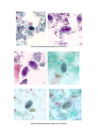 Cistos de Giardia lamblia corados com tricrômico.
Cistos de Giardia lamblia corados com tricrômico.
 