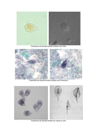 Trofozoítos de Giardia lamblia corados com iodo.
Trofozoítos de Giardia lamblia corados com tricrômico.
Trofozoítos de Giardia lamblia em cultura in vitro.
 