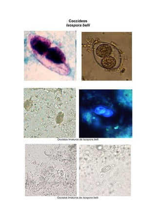 Coccídeos
Isospora belli
Oocistos Imaturos de Isospora belli
Oocistos Imaturos de Isospora belli.
 
