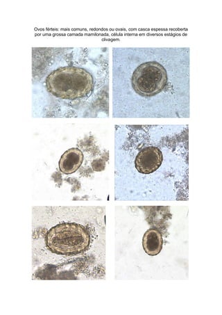 Ovos férteis: mais comuns, redondos ou ovais, com casca espessa recoberta
por uma grossa camada mamilonada, célula interna em diversos estágios de
clivagem.
 