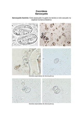 Coccídeos
Sarcocystis
Sarcocystis hominis: Ciclo assexuado no gado (no tecido) e ciclo sexuado na
espécie humana (intestino)
Oocistos esporulados de Sarcocystis sp.
Oocistos esporulados de Sarcocystis sp.
 