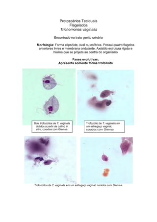 Protozoários Teciduais
Flagelados
Trichomonas vaginalis
Encontrado no trato genito urinário
Morfologia: Forma elipsóide, oval ou esférica. Possui quatro flagelos
anteriores livres e membrana ondulante. Axóstilo estrutura rígida e
hialina que se projeta ao centro do organismo
Fases evolutivas:
Apresenta somente forma trofozoíta
Trofozoítos de T. vaginalis em um esfregaço vaginal, corados com Giemsa.
Dois trofozoítos de T. vaginalis
obtidos a partir de cultivo in
vitro, coradas com Giemsa.
Trofozoíto de T. vaginalis em
um esfregaço vaginal,
corados com Giemsa
 