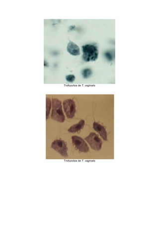 Trofozoítos de T. vaginalis
Trofozoítos de T. vaginalis
 
