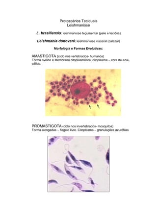 Protozoários Teciduais
Leishmaniose
L. brasiliensis: leishmaniose tegumentar (pele e tecidos)
Leishmania donovani: leishmaniose visceral (calazar)
Morfologia e Formas Evolutivas:
AMASTIGOTA (ciclo nos vertebrados- humanos)
Forma ovóide e Membrana citoplasmática, citoplasma – cora de azul-
pálido.
PROMASTIGOTA (ciclo nos invertebrados- mosquitos)
Forma alongadas – flagelo livre. Citoplasma – granulações azurófilas
 