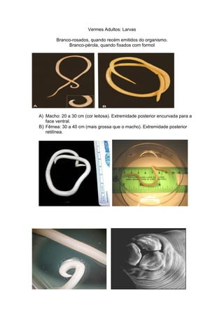 Vermes Adultos: Larvas
Branco-rosados, quando recém emitidos do organismo.
Branco-pérola, quando fixados com formol
A) Macho: 20 a 30 cm (cor leitosa). Extremidade posterior encurvada para a
face ventral.
B) Fêmea: 30 a 40 cm (mais grossa que o macho). Extremidade posterior
retilínea.
 
