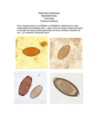 Helmintos Intestinais
Nematelmintos
Tricuríase
Trichuris trichiura
Ovos: Aspecto típico a um BARRIL ou BANDEJA. Opérculos em cada
extremidade de tonalidade clara – agem como se fossem rolhas que fazem
a retenção da massa celular germinativa do futuro embrião. Restante do
ovo – cor castanha. Dimensão 50µm
 