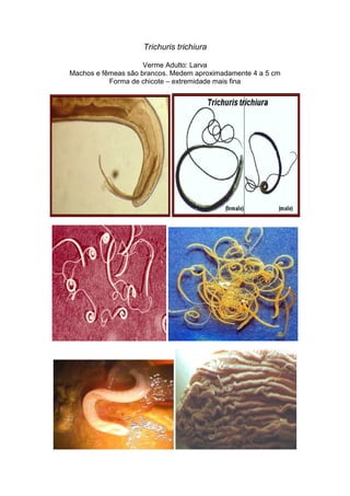 Trichuris trichiura
Verme Adulto: Larva
Machos e fêmeas são brancos. Medem aproximadamente 4 a 5 cm
Forma de chicote – extremidade mais fina
 