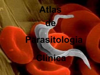 Atlas
de
Parasitologia

Clínica

 