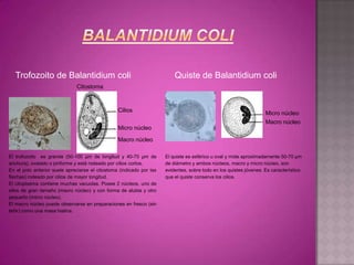 Trofozoito de Balantidium coli

Quiste de Balantidium coli

Citostoma

Cilios

Micro núcleo
Macro núcleo

Micro núcleo
Macro núcleo
El trofozoito es grande (50-100 µm de longitud y 40-70 µm de
anchura), ovalado o piriforme y está rodeado por cilios cortos.
En el polo anterior suele apreciarse el citostoma (indicado por las
flechas) rodeado por cilios de mayor longitud.
El citoplasma contiene muchas vacuolas. Posee 2 núcleos, uno de
ellos de gran tamaño (macro núcleo) y con forma de alubia y otro
pequeño (micro núcleo).
El macro núcleo puede observarse en preparaciones en fresco (sin
teñir) como una masa hialina.

El quiste es esférico u oval y mide aproximadamente 50-70 µm
de diámetro y ambos núcleos, macro y micro núcleo, son
evidentes, sobre todo en los quistes jóvenes. Es característico
que el quiste conserva los cilios.

 