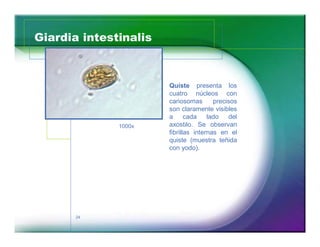 Giardia intestinalis 
24 
‡ Quíste presenta los 
cuatro núcleos con 
cariosomas precisos 
son claramente visibles 
a cada lado del 
axostilo. Se observan 
fibrillas internas en el 
quiste (muestra teñida 
con yodo). 
1000x 
 