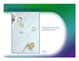 Comparación tamaños 
42 
Blastocystis hominis y 
Endolimax nana 
1000x 
 