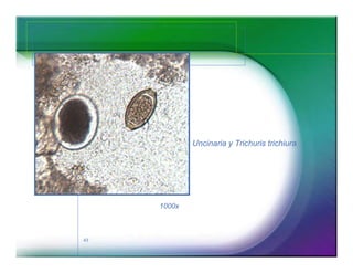 43 
Uncinaria y Trichuris trichiura 
1000x 
 