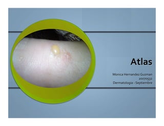 Atlas dermatologia