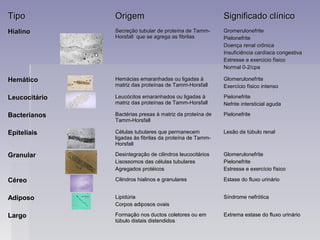 TipoTipo OrigemOrigem Significado clínicoSignificado clínico
HialinoHialino Secreção tubular de proteína de Tamm-Secreção tubular de proteína de Tamm-
Horsfall que se agrega as fibrilasHorsfall que se agrega as fibrilas
GromerulonefriteGromerulonefrite
PielonefritePielonefrite
Doença renal crônicaDoença renal crônica
Insuficiência cardíaca congestivaInsuficiência cardíaca congestiva
Estresse e exercicio físicoEstresse e exercicio físico
Normal 0-2/cpaNormal 0-2/cpa
HemáticoHemático Hemácias emaranhadas ou ligadas àHemácias emaranhadas ou ligadas à
matriz das proteínas de Tamm-Horsfallmatriz das proteínas de Tamm-Horsfall
GlomerulonefriteGlomerulonefrite
Exercício físico intensoExercício físico intenso
LeucocitárioLeucocitário Leucócitos emaranhados ou ligadas àLeucócitos emaranhados ou ligadas à
matriz das proteínas de Tamm-Horsfallmatriz das proteínas de Tamm-Horsfall
PielonefritePielonefrite
Nefrite intersticial agudaNefrite intersticial aguda
BacterianosBacterianos Bactérias presas à matriz da proteína deBactérias presas à matriz da proteína de
Tamm-HorsfallTamm-Horsfall
PielonefritePielonefrite
EpiteliaisEpiteliais Células tubulares que permanecemCélulas tubulares que permanecem
ligadas às fibrilas da proteína de Tamm-ligadas às fibrilas da proteína de Tamm-
HorsfallHorsfall
Lesão de túbulo renalLesão de túbulo renal
GranularGranular Desintegração de cilindros leucocitáriosDesintegração de cilindros leucocitários
Lisossomos das células tubularesLisossomos das células tubulares
Agregados protéicosAgregados protéicos
GlomerulonefriteGlomerulonefrite
PielonefritePielonefrite
Estresse e exercício físicoEstresse e exercício físico
CéreoCéreo Cilindros hialinos e granularesCilindros hialinos e granulares Estase do fluxo urinárioEstase do fluxo urinário
AdiposoAdiposo LipidúriaLipidúria
Corpos adiposos ovaisCorpos adiposos ovais
Síndrome nefróticaSíndrome nefrótica
LargoLargo Formação nos ductos coletores ou emFormação nos ductos coletores ou em
túbulo distais distendidostúbulo distais distendidos
Extrema estase do fluxo urinárioExtrema estase do fluxo urinário
 