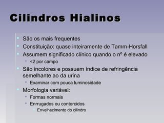 Cilindros HialinosCilindros Hialinos
 São os mais frequentesSão os mais frequentes
 Constituição: quase inteiramente de Tamm-HorsfallConstituição: quase inteiramente de Tamm-Horsfall
 Assumem significado clínico quando o nº é elevadoAssumem significado clínico quando o nº é elevado
 <2 por campo<2 por campo
 São incolores e possuem índice de refringênciaSão incolores e possuem índice de refringência
semelhante ao da urinasemelhante ao da urina
 Examinar com pouca luminosidadeExaminar com pouca luminosidade
 Morfologia variável:Morfologia variável:
 Formas normaisFormas normais
 Enrrugados ou contorcidosEnrrugados ou contorcidos
 Envelhecimento do cilindroEnvelhecimento do cilindro
 