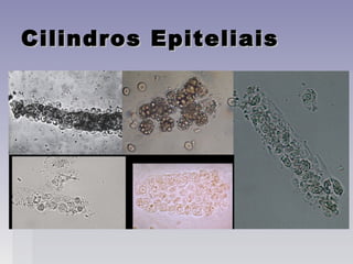 Cilindros EpiteliaisCilindros Epiteliais
 