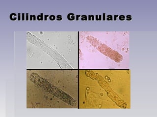 Cilindros GranularesCilindros Granulares
 