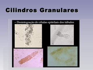 Cilindros GranularesCilindros Granulares
 