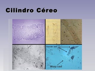 Cilindro CéreoCilindro Céreo
 